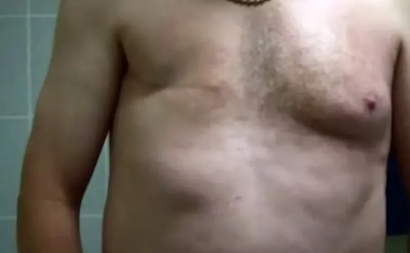 Huit pour cent des hommes éthiopiens sont touchés par le cancer du sein