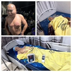 Les victimes chinoises blessées