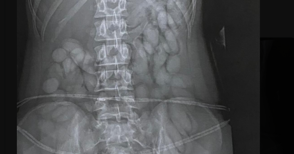 Le haut policier Masemola félicite la police après les saisies de drogue d'ORTIA