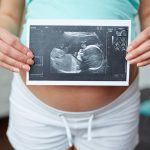 Les experts appellent à un meilleur accès aux soins prénatals pour les femmes