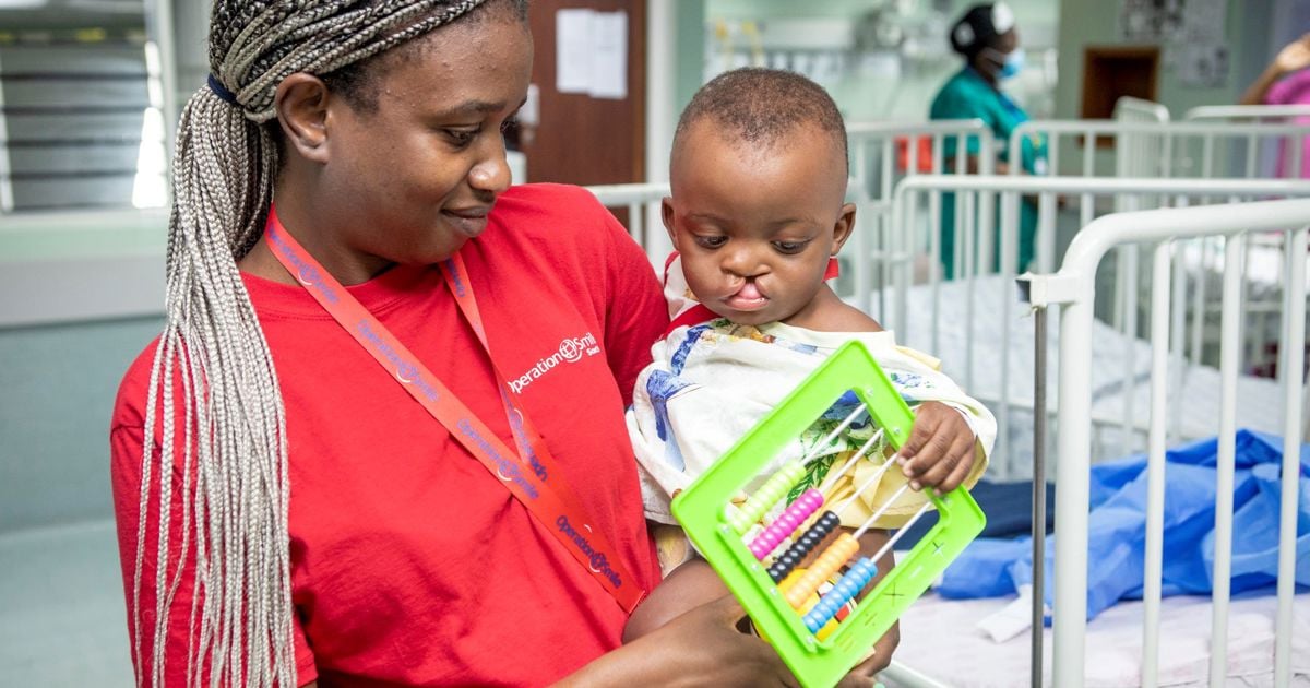 Opération Smile vise à effectuer 25 chirurgies libres de la fente de la fente et du palais à Mbombela