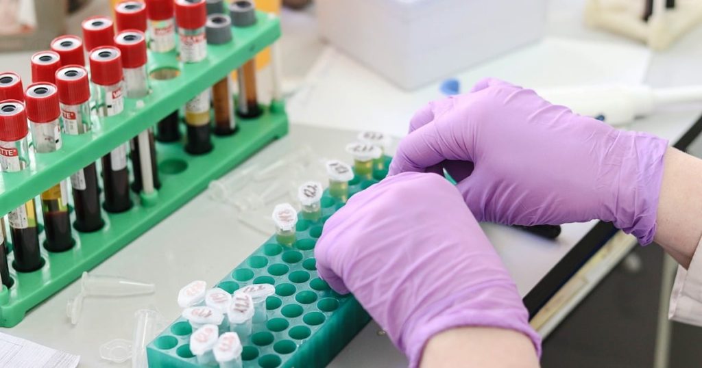 National Health Laboratory Services s'adresse