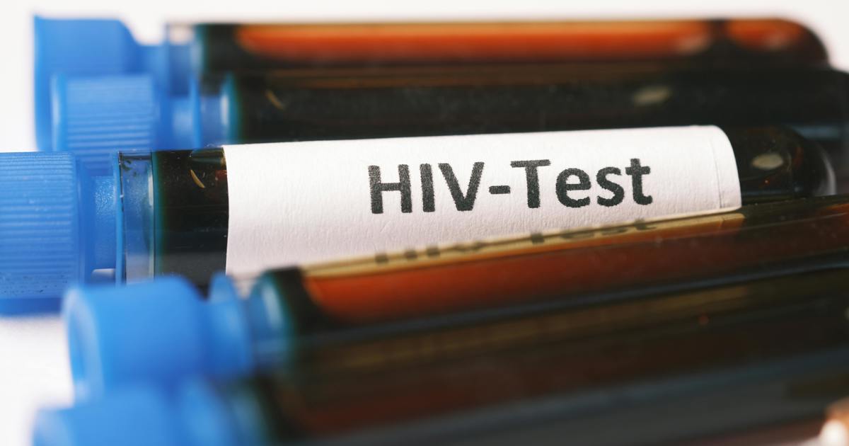 Le ministère de la Santé est invité à garantir la responsabilité dans le déploiement des médicaments anti-VIH