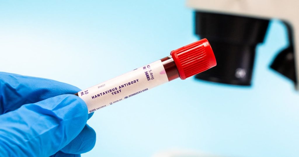 Un patient atteint d'hantavirus en Afrique du Sud s'améliore alors que l'OMS surveille les cas mondiaux