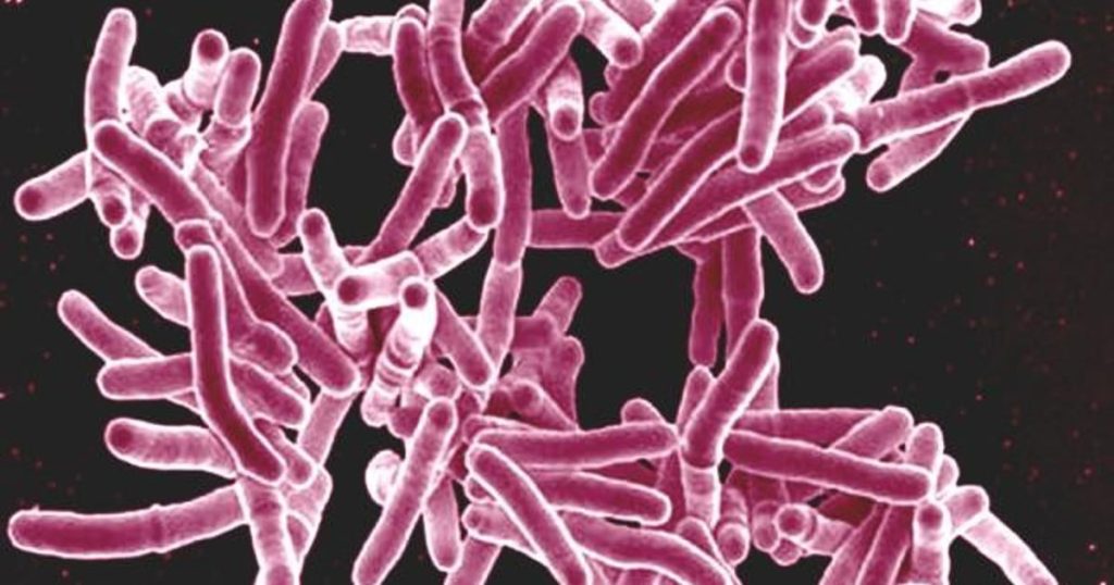 Avancement important réalisé dans le traitement de la tuberculose