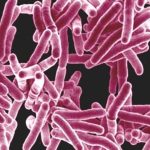 Avancement important réalisé dans le traitement de la tuberculose