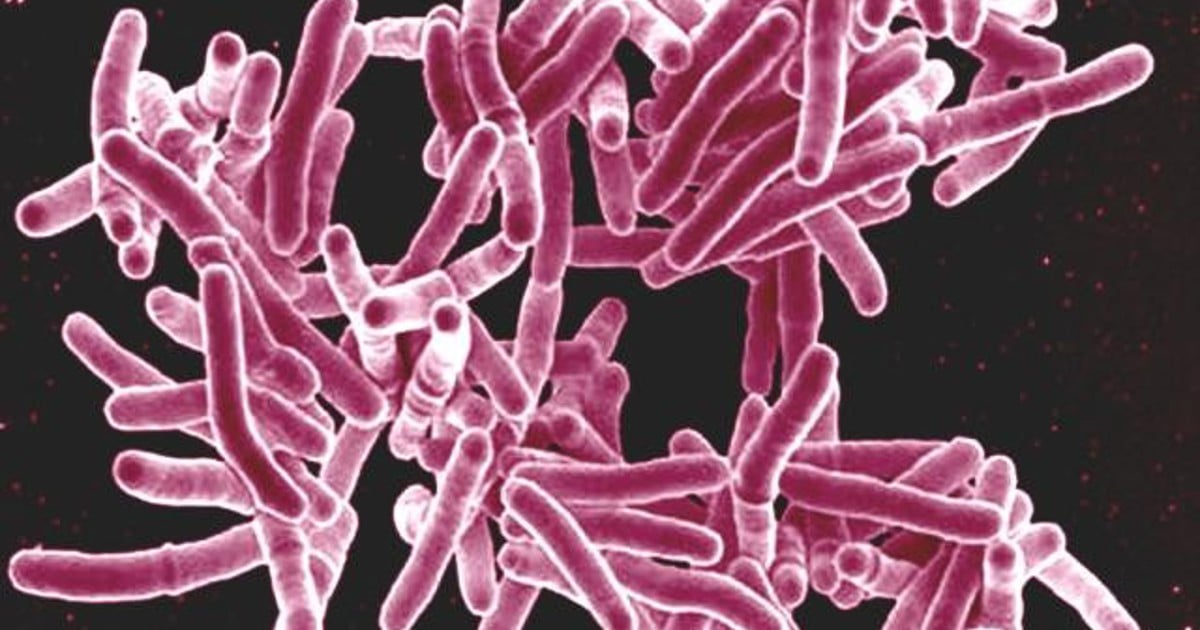 Avancement important réalisé dans le traitement de la tuberculose