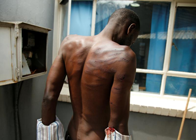 « Les schémas récurrents de violations des droits humains, de discrimination et de coercition au Zimbabwe restent préoccupants », déclare l'organisme de surveillance.
