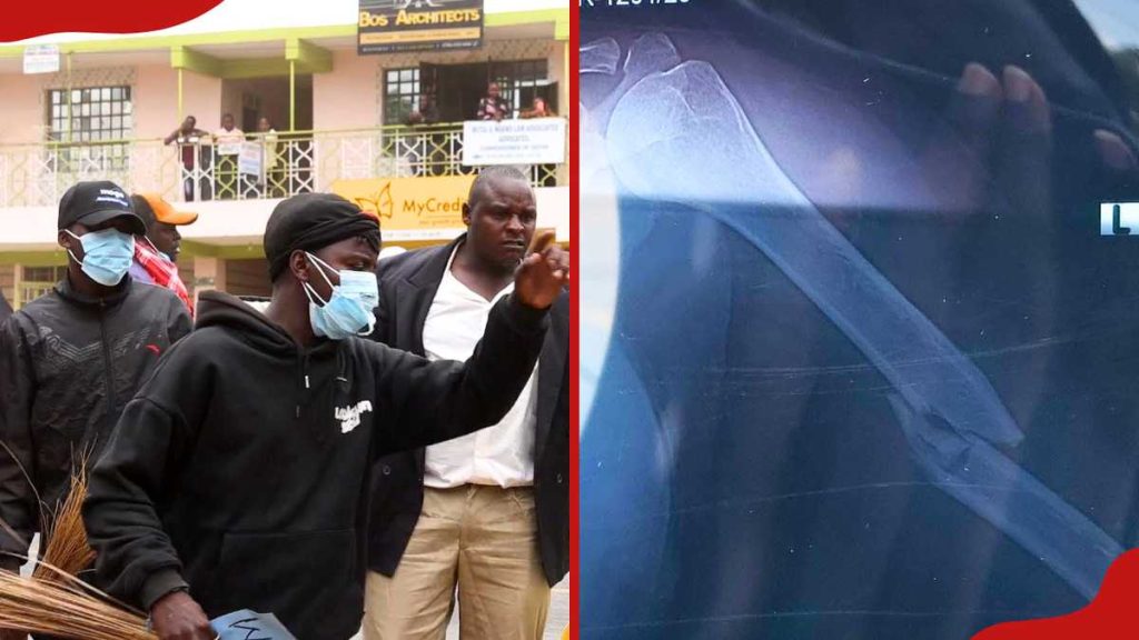 Makueni : des crétins attaquent et blessent des agents cliniques lors d'une manifestation devant le bureau du gouverneur
