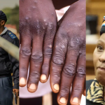 Vos top stories du vendredi | La nationalité du suspect d'Ekurhuleni n'est pas confirmée, les cas de Mpox augmentent, Mapisa-Nqakula grillée